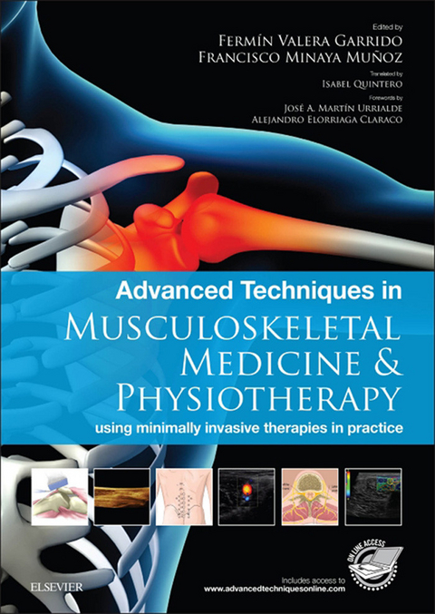 Advanced Techniques in Musculoskeletal Medicine & Physiotherapy - E-Book -  Fermin Valera Garrido,  Francisco Minaya Munoz