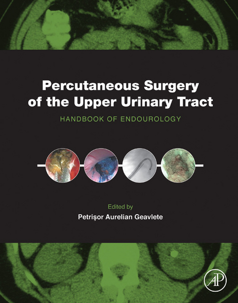 Percutaneous Surgery of the Upper Urinary Tract - 