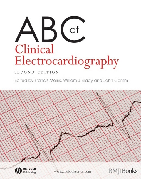 ABC of Clinical Electrocardiography - 