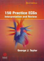 150 Practice ECGs - George J. Taylor