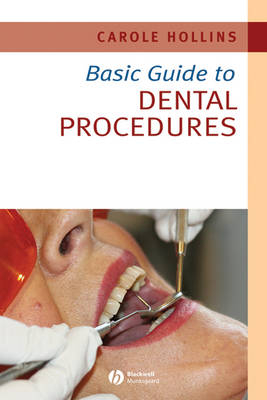 Basic Guide to Dental Procedures - Carole Hollins