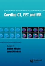 Cardiac CT, PET and MR - 