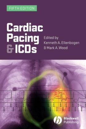 Cardiac Pacing and ICDs - Kenneth A. Ellenbogen, Mark A. Wood