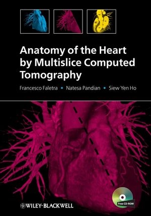 Anatomy of the Heart by Multislice Computed Tomography - Francesco Faletra, Natesa Pandian, Siew Yen Ho