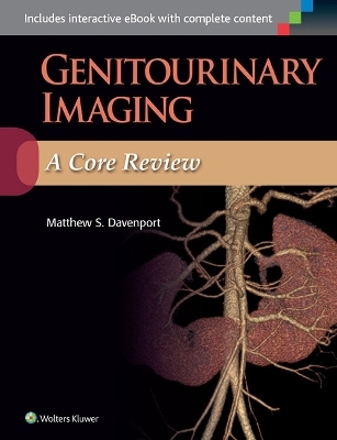 Genitourinary Imaging: A Core Review - Matthew S. Davenport