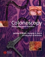 Colonoscopy - 