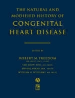 The Natural and Modified History of Congenital Heart Disease - 