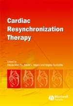 Cardiac Resynchronization Therapy - 
