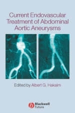 Current Endovascular Treatment of Abdominal Aortic Aneurysms - 