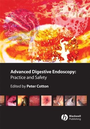 Advanced Digestive Endoscopy - P Cotton