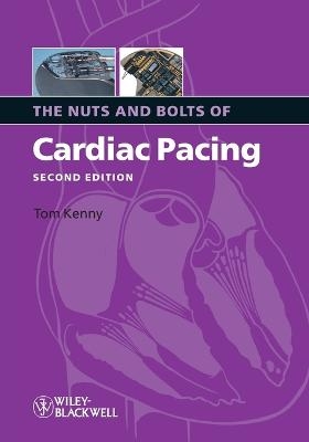 The Nuts and Bolts of Cardiac Pacing - Tom Kenny