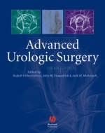 Advanced Urologic Surgery - 