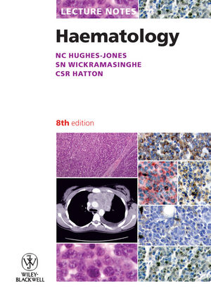 Lecture Notes: Haematology - Nevin C. Hughes-Jones, S. N Wickramasinghe, Chris Hatton