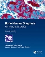 Bone Marrow Diagnosis - D Brown