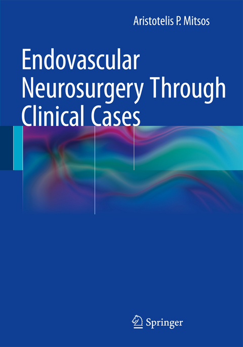 Endovascular Neurosurgery Through Clinical Cases - Aristotelis P. Mitsos