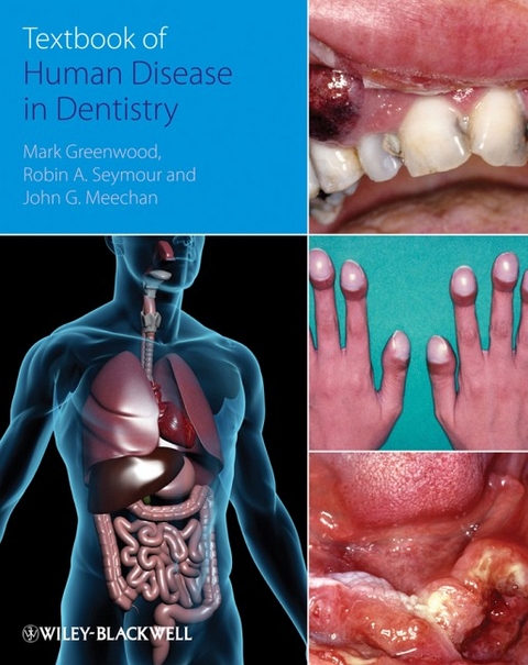 Textbook of Human Disease in Dentistry - Mark Greenwood, Robin Seymour, John Meechan