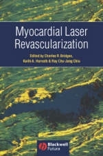 Myocardial Laser Revascularization - 