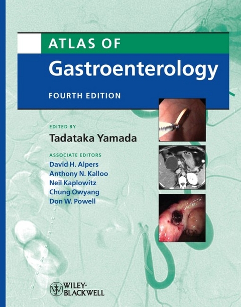 Atlas of Gastroenterology - 