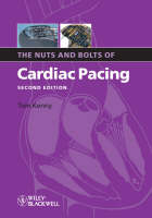 The Nuts and Bolts of Cardiac Pacing - Tom Kenny