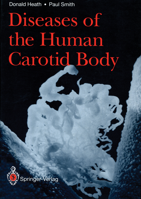 Diseases of the Human Carotid Body - Donald Heath, Paul Smith