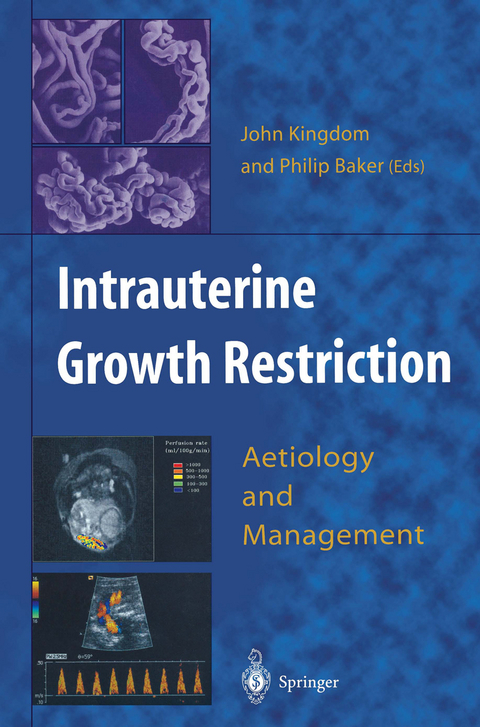 Intrauterine Growth Restriction - 