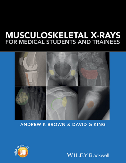Musculoskeletal X-Rays for Medical Students and Trainees -  Andrew Brown,  David G. King