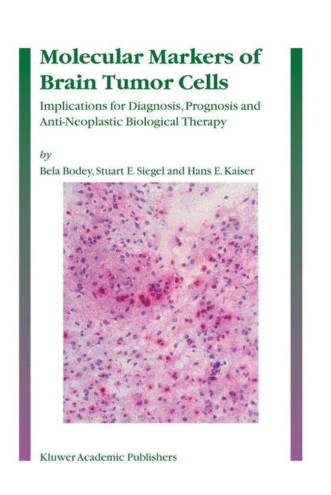 Molecular Markers of Brain Tumor Cells - Bela Bodey, Stuart E. Siegel, Hans E. Kaiser
