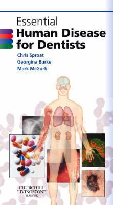 Essential Human Disease for Dentists E-Book -  Georgina Burke,  Mark McGurk,  Christopher Sproat
