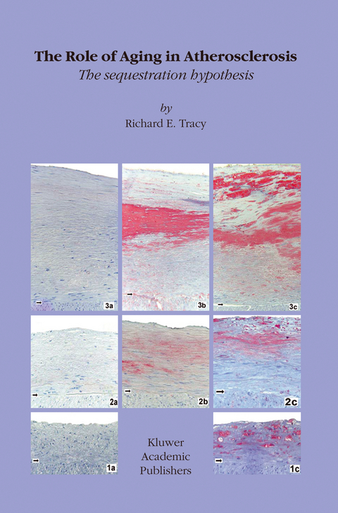 The Role of Aging in Atherosclerosis - R.E. Tracy