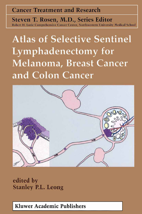 Atlas of Selective Sentinel Lymphadenectomy for Melanoma, Breast Cancer and Colon Cancer - 