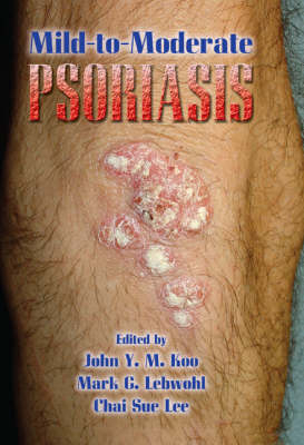 Mild-to-Moderate Psoriasis - 