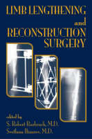 Limb Lengthening and Reconstruction Surgery - 