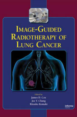 Image-Guided Radiotherapy of Lung Cancer - 