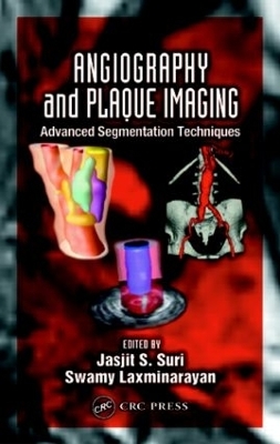 Angiography and Plaque Imaging - 