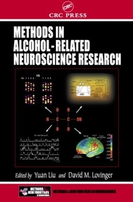 Methods in Alcohol-Related Neuroscience Research - 