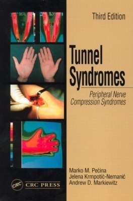 Tunnel Syndromes - Marko M. Pecina, Andrew D. Markiewitz, Jelena Krmpotic-Nemanic