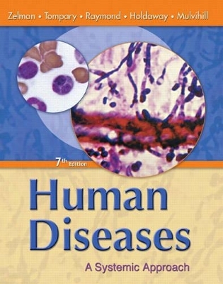 Human Diseases - Mark Zelman  Ph.D., Elaine Tompary, Jill Raymond, Paul Holdaway, Mary Lou E. Mulvihill