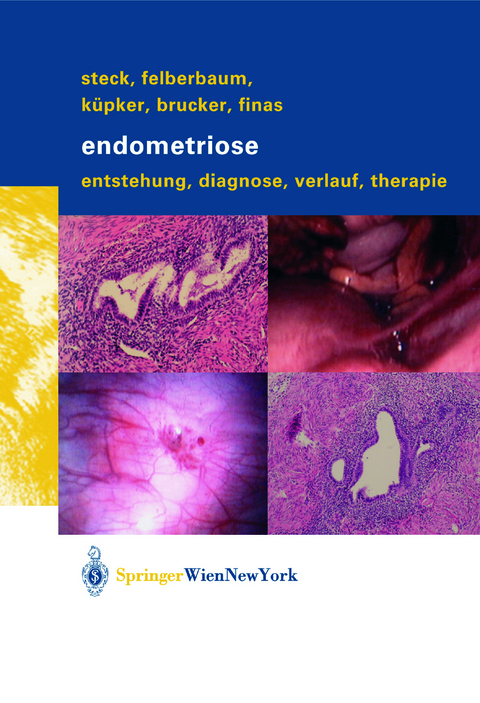 Endometriose - Thomas Steck, Ricardo E. Felberbaum, Wolfgang Küpker, Cosima Brucker, Dominique F. Finas