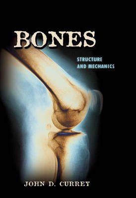 Bones - John D. Currey