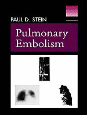 Pulmonary Embolism - D.Paul Stein
