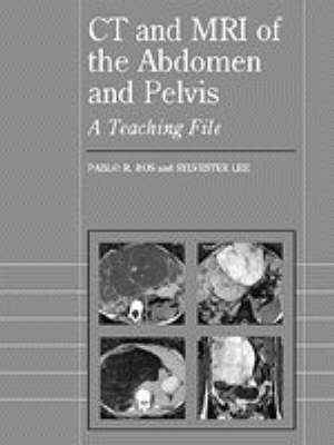 CT and MRI of the Abdomen and Pelvis - Pablo R. Ros, Sylvester Lee