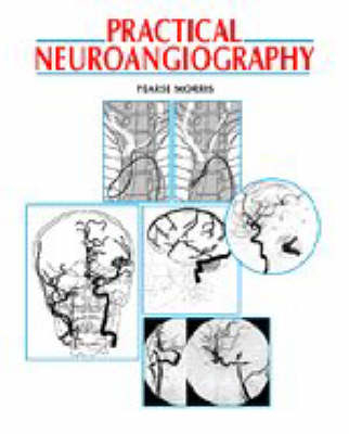 Practical Neuroangiography - P. Pearse Morris