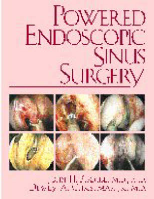 Powered Endoscopic Sinus Surgery - John H. Krouse, Dewey A. Christmas Jr