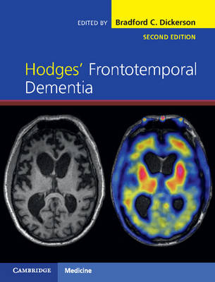 Hodges' Frontotemporal Dementia - 