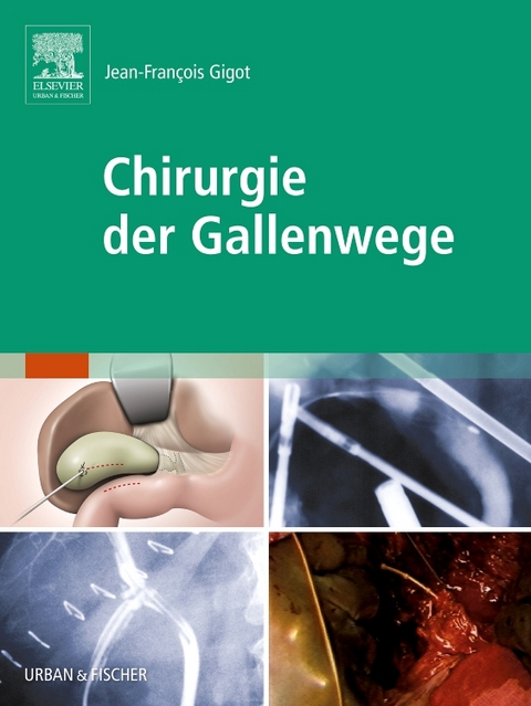 Chirurgie der Gallenwege - 