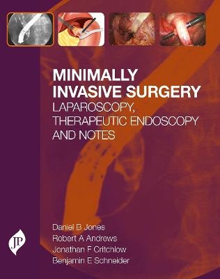 Minimally Invasive Surgery - Daniel  B Jones, Robert Andrews, Jonathan F Critchlow, Benjamin E Schneider