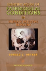 Identification of Pathological Conditions in Human Skeletal Remains - Donald J. Ortner