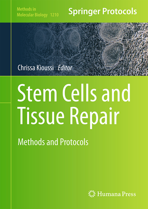 Stem Cells and Tissue Repair - 