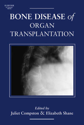 Bone Disease of Organ Transplantation - 