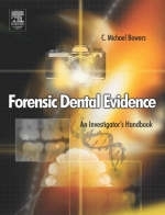 Forensic Dental Evidence - 